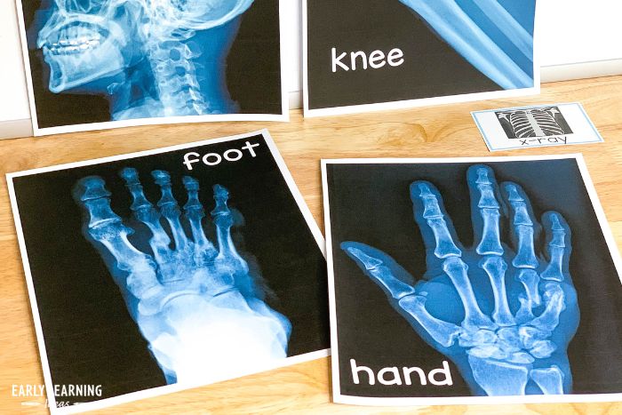 Use x-rays as part of your doctor dramatic play center.