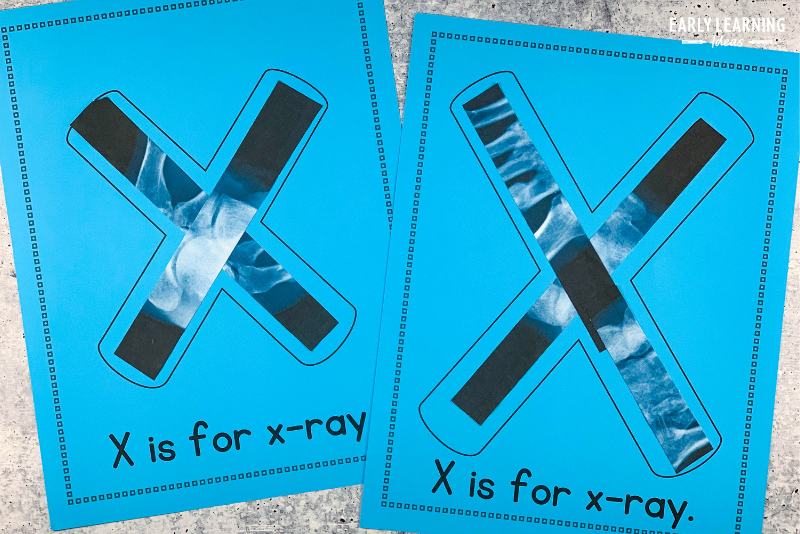 Letter x is for x-ray alphabet activity collage.  strips of an x-ray picture are glued to the letter x on the printable page